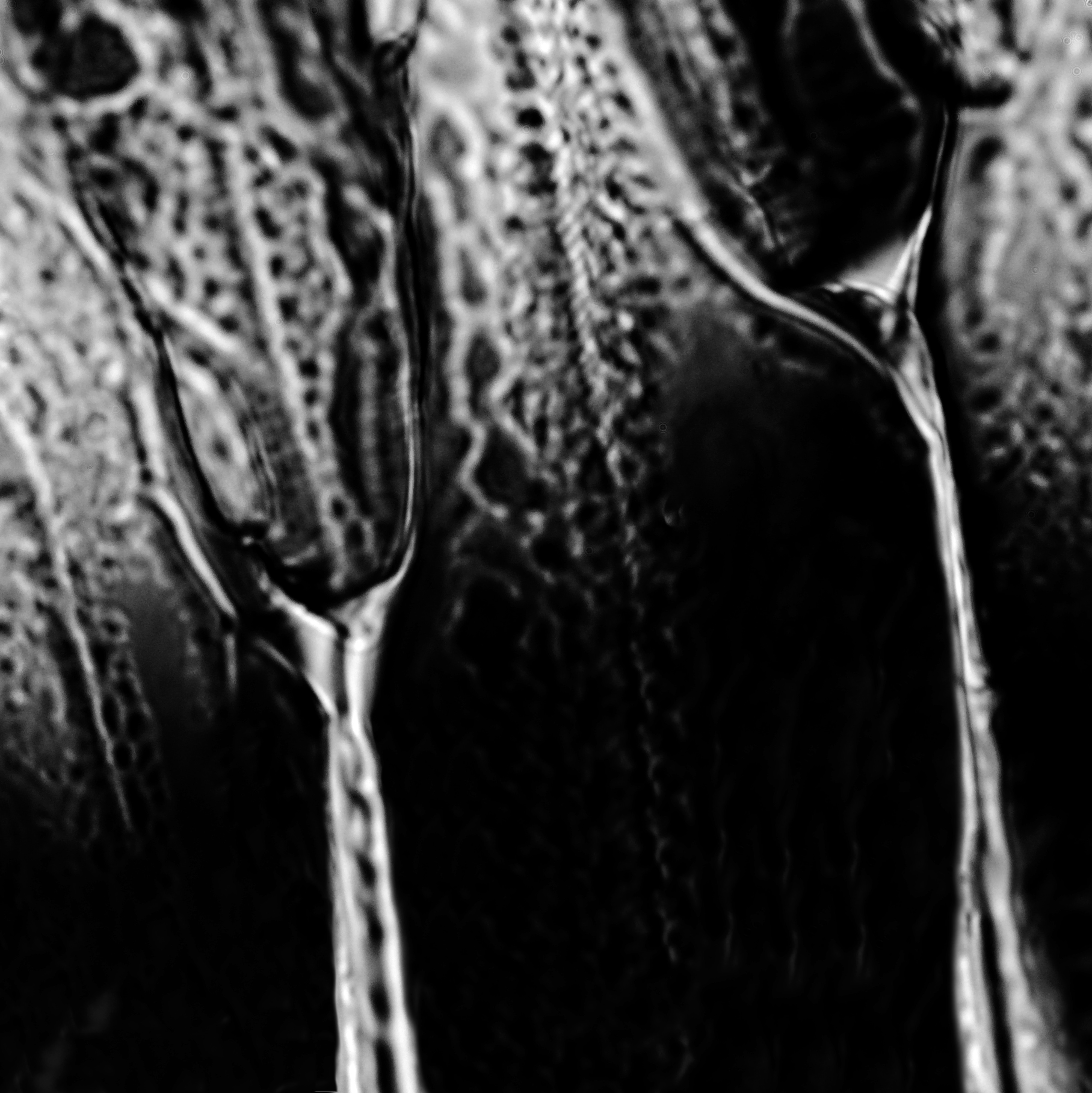 citric acid from 2-propanol, field of view not documented 