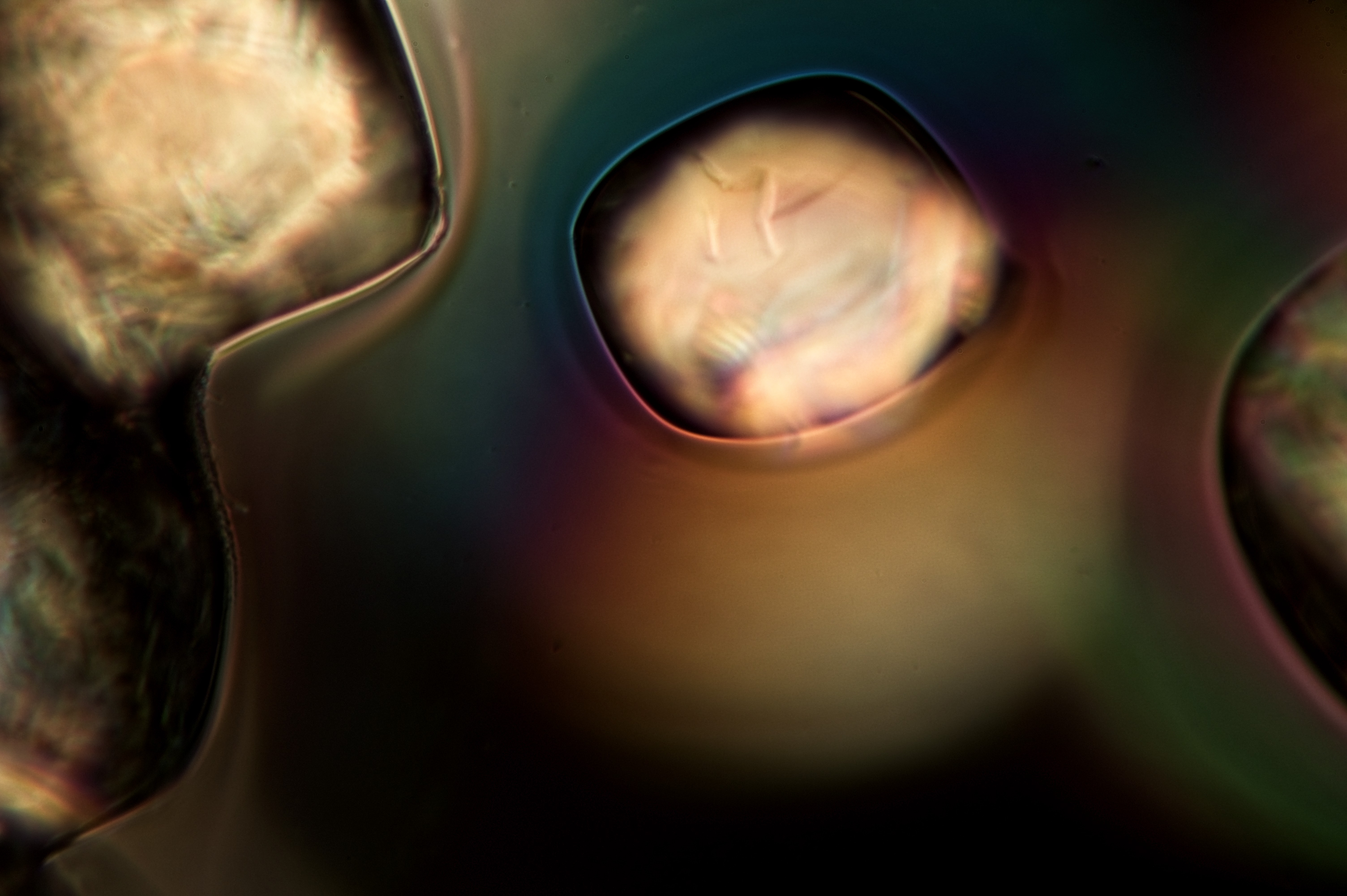 saccharose from water, field of view not documented